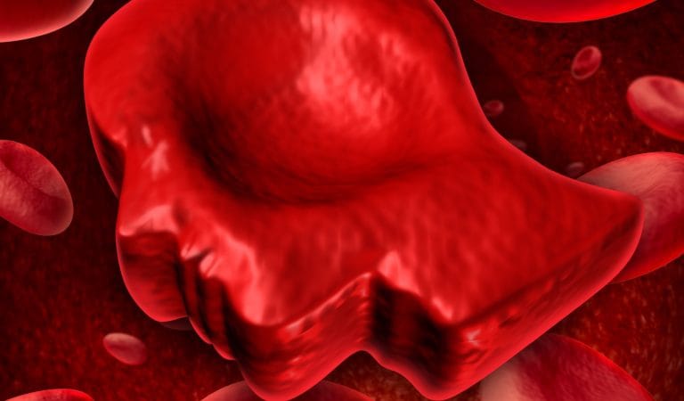 Neurodiversity Is a Strawman