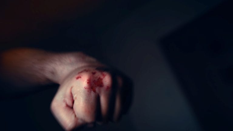 The Instinct to Hurt Those with Whom One Disagrees