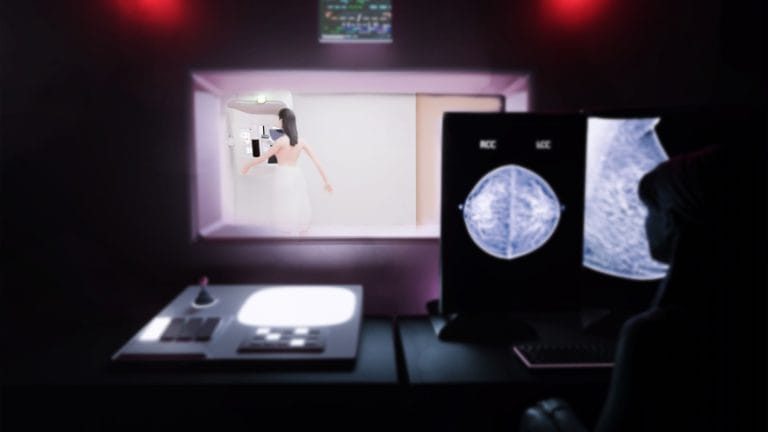 The Three Big Lies about Mammography Screening