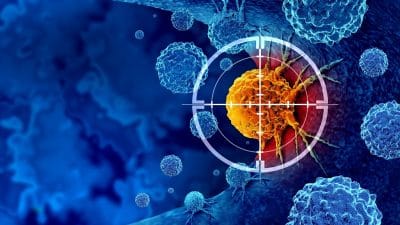 The Trouble with Cancer Screening in Healthy Adults