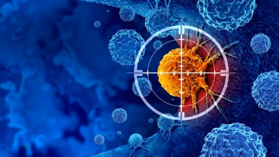 The Trouble with Cancer Screening in Healthy Adults